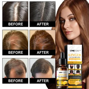 LIMETOW™ Anti-Hair Loss Treatment Essence