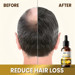 LIMETOW™ Anti-Hair Loss Treatment Essence