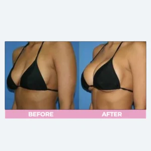 LIMETOW™ Breast Enhance Cream