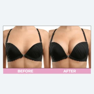 LIMETOW™ Breast Enhance Cream