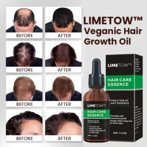 LIMETOW™ Veganic Hair Growth Oil