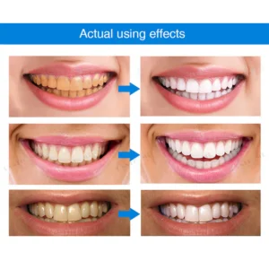 LUMINA™ Teeth Whitening Essence