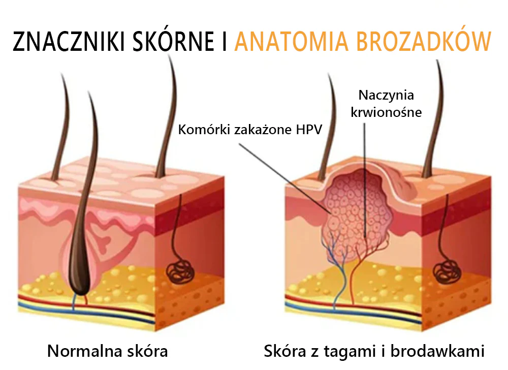 Lenaro™ Krem leczący znamiona i brodawki z jadem pszczelim