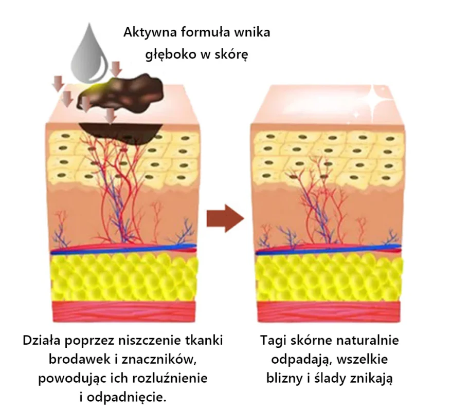 Lenaro™ Krem leczący znamiona i brodawki z jadem pszczelim