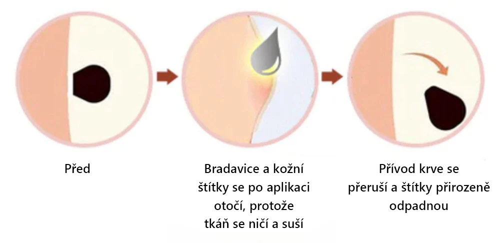 Lenaro™ Krem leczący znamiona i brodawki z jadem pszczelim