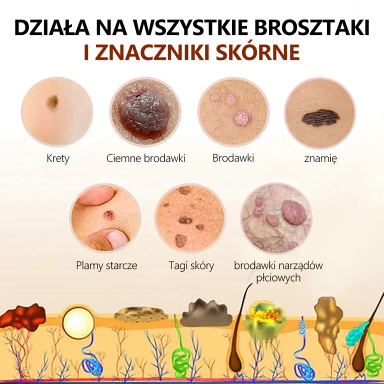 Lenaro™ Krem leczący znamiona i brodawki z jadem pszczelim