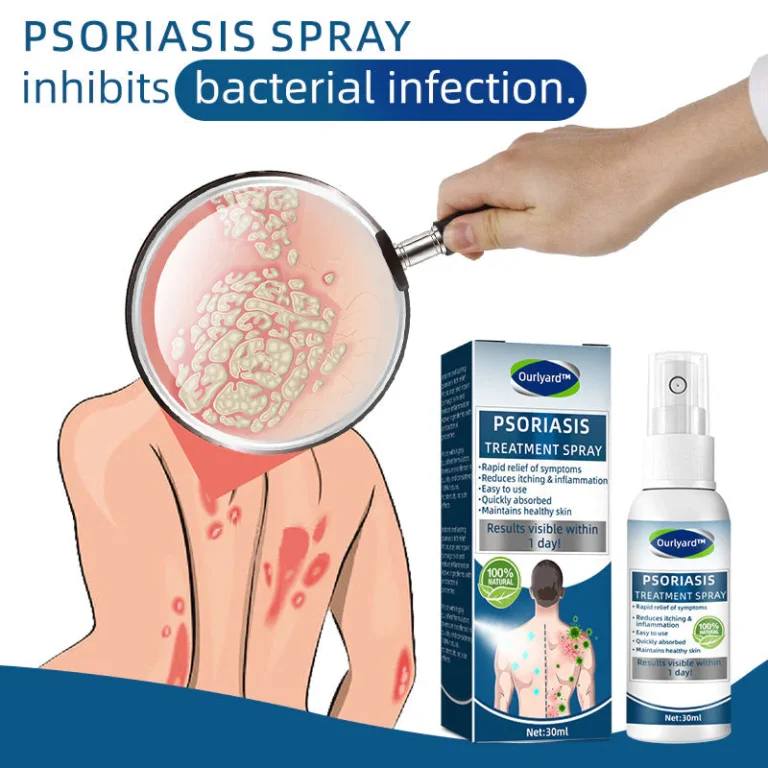 Ourlyard™ Psoriasis Treatment Spray