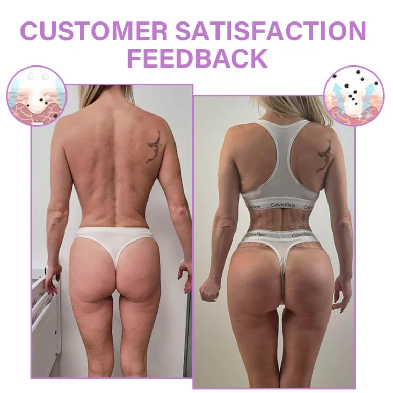 Seurico™ Bottom Enhancement Posterior Shaping Cream