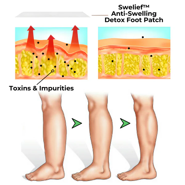 Swelief™ Anti-Swelling Detox Foot Patch