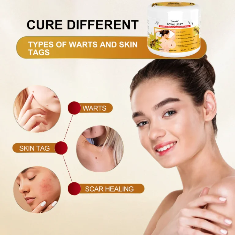 Tiword™ Bee Venom Mole and Wart Treatment Cream