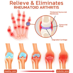 DeerAntler Joint and Bone Therapy Balm