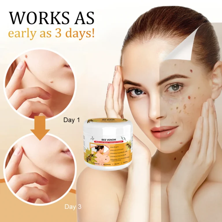 Bee Venom Mole and Wart Treatment Cream