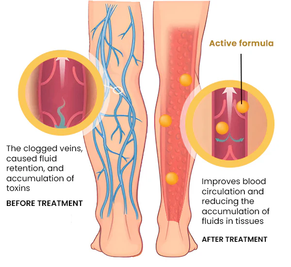 BeeSyrx ™ Lymphatic & Slimming Foot Soak