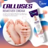 CallusPro™Calluses Remove Cream