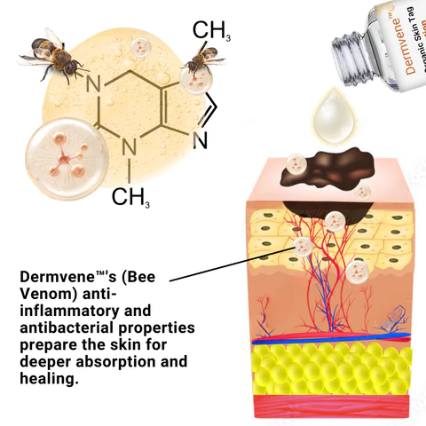 Dermvene™ Organic Skin Tag Solution