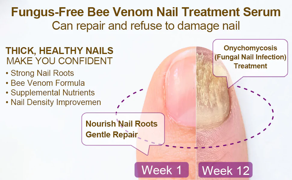 Dobshow™ Fungus-Free Bee Venom Nail Treatment Serum