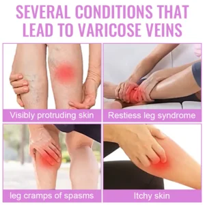 Dobshow™ Varicose Veins Cream