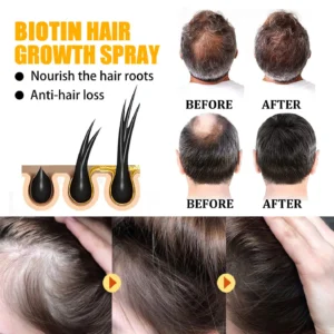 Dobshow™Biotin Premium Hair Growth Serum