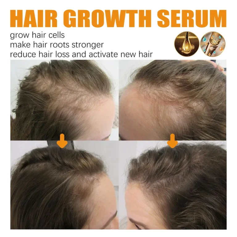 Dobshow™Biotin Premium Hair Growth Serum