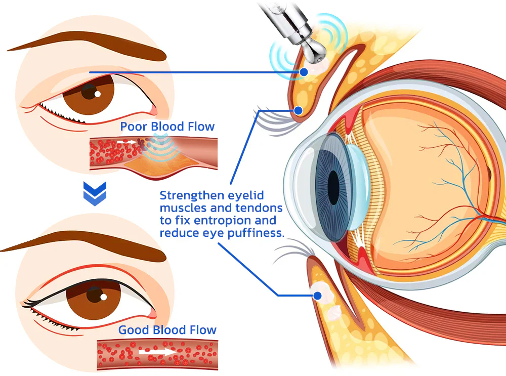 Furzero™ OIC Deer Placenta Lifting Eyelid Electric Serum Pen