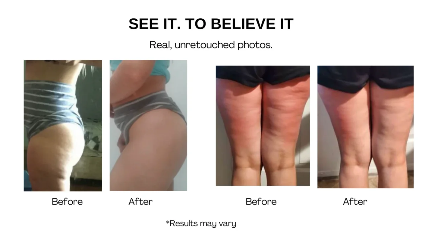 HerbalFusion™ Generation II Cellulite Targeting Patches