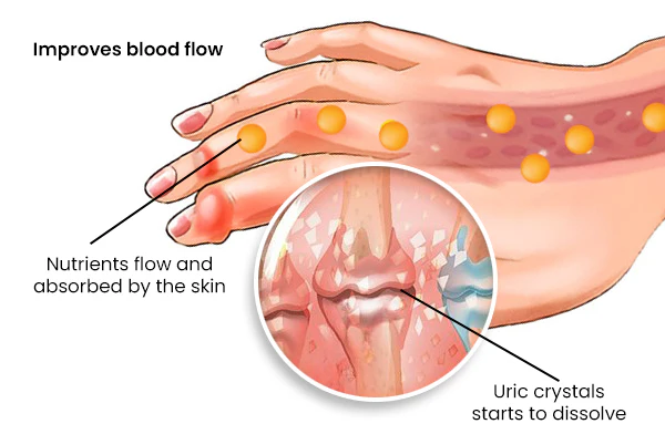 OsteoBee™ Gout Relief Foot Soak