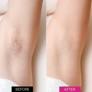 Oveallgo™ BeeSilk Hair Removal Mousse