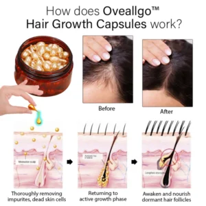 Oveallgo™ Hair Growth Capsules