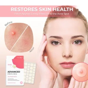 Oveallgo™ PowerClear Advanced Acne Pimple Patches