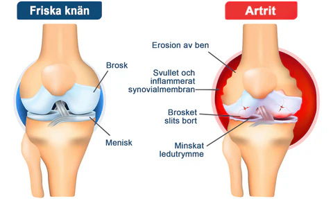 Raindew™ Bivengift Professionell behandling av ledgel