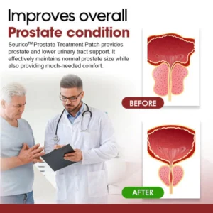 Seurico™ Prostate Treatment Patch