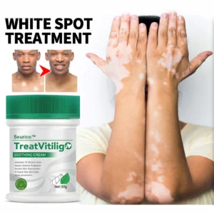 Seurico™ TreatVitiligo Soothing Cream