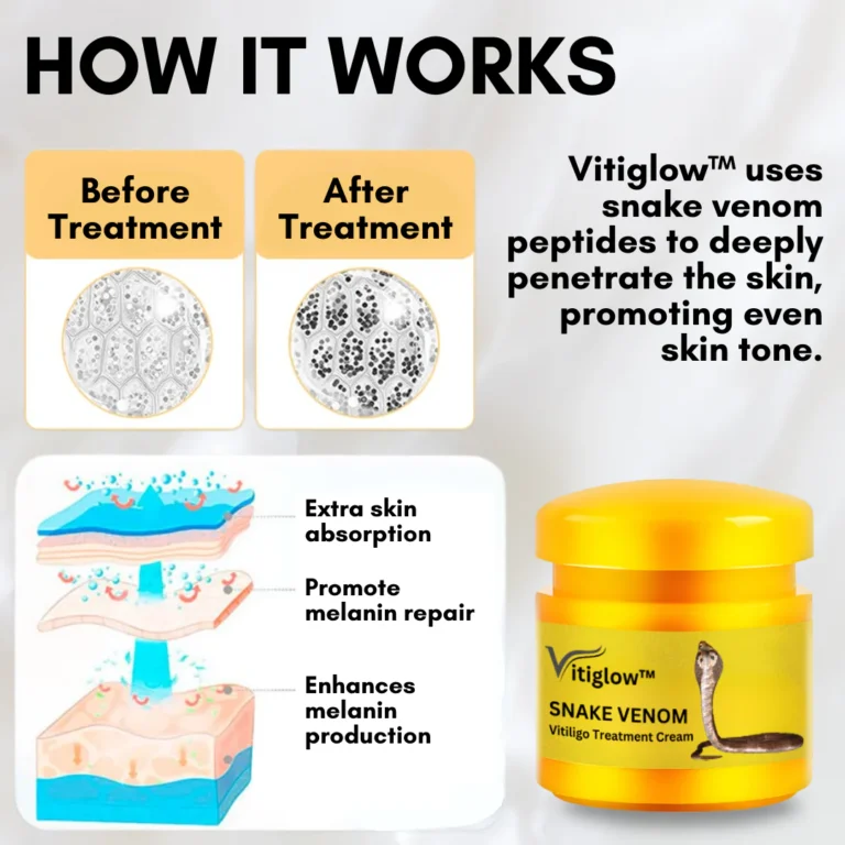 Vitiglow™ Snake Venom Vitiligo Treatment Cream