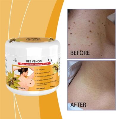 Dobshow™Bee Venom Mole and Wart Treatment Cream