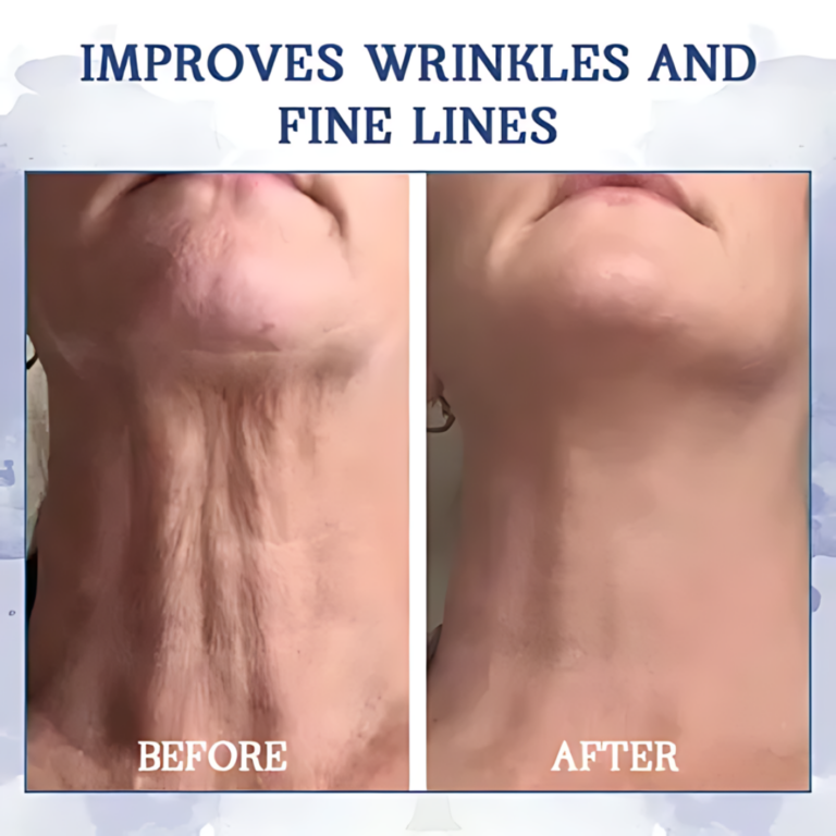 AEXZR® Advanced Firming & Wrinkle-Reducing Cream