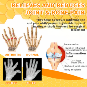 Bee Venom Joint Therapy Pain Relief Gel