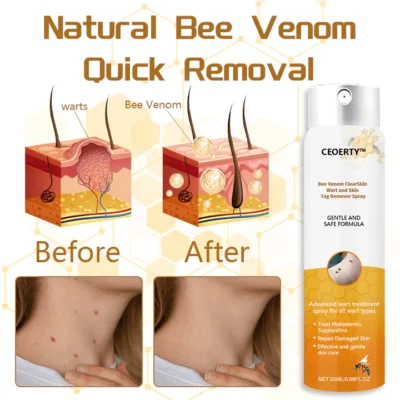 Ceoerty™ Bee Venom ClearSkin Wart and Skin Tag Remover Spray
