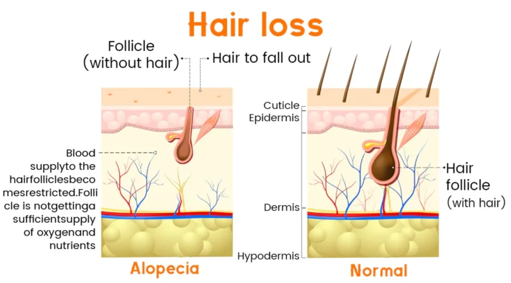 Dobshow™ Premium Biotin Hair&Beard Booster Atomizing