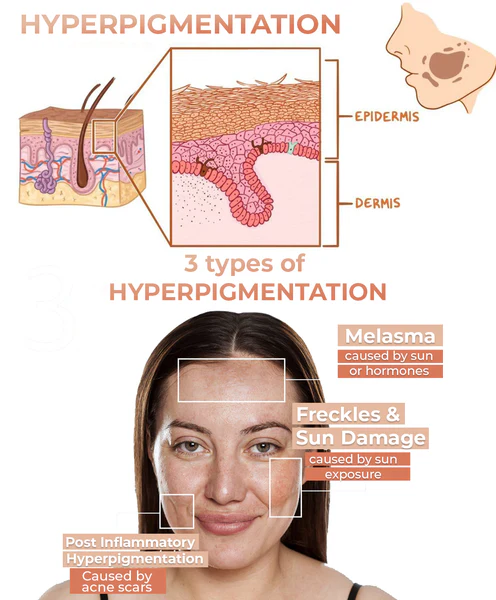 NESLEMY™ Turmeric Spot Repair Serum