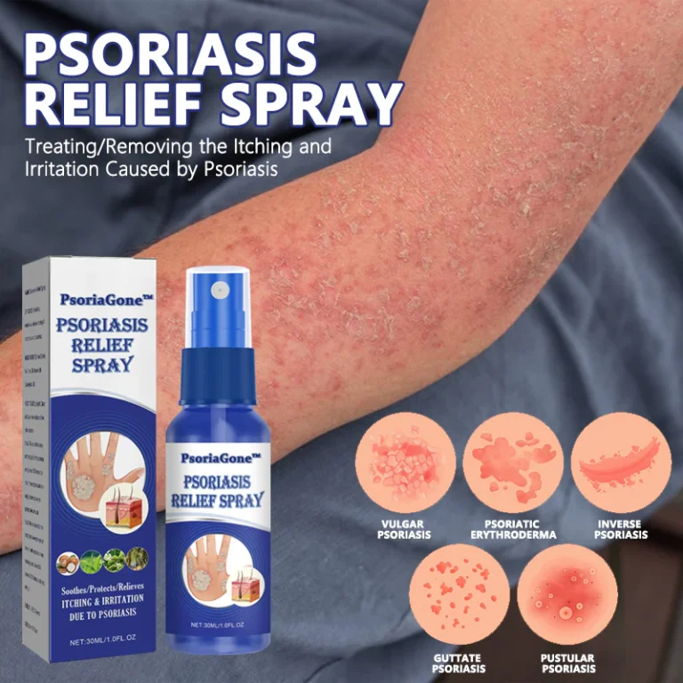 ORGANIC PSORIASIS CHICKWEED RELIEF SPRAY