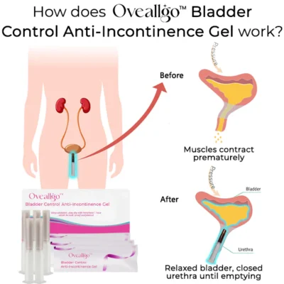 Oveallgo™ Bladder Control Anti-Incontinence Gel