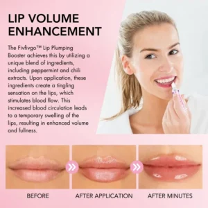 Oveallgo™ Lip Plumping Booster