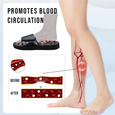 Oveallgo™ ReflexoSoothe Acupressure Sandals