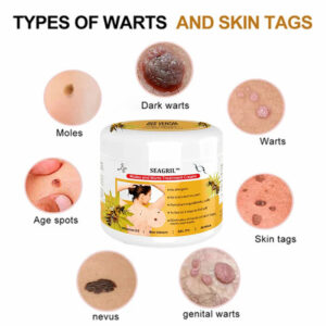 SEAGRIL™ Bee Venom Mole and Wart Treatment Cream