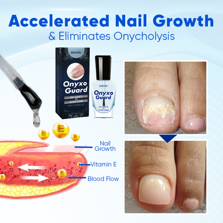 SEAGRIL™ OnyxoGuard Nail Growth and Repair Serum