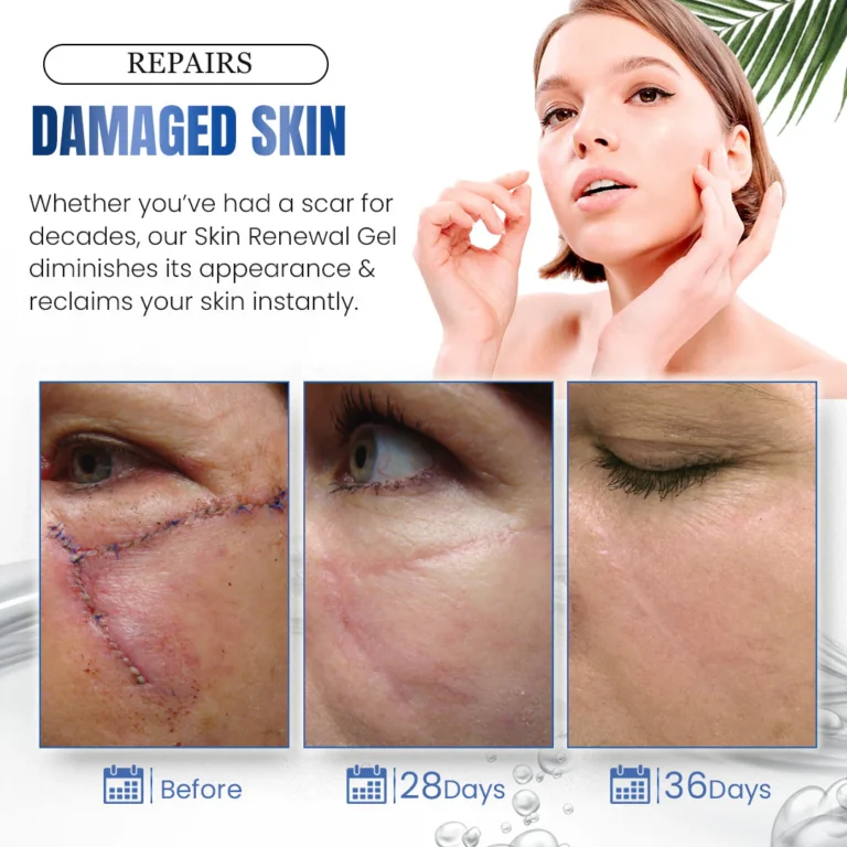 Seurico™ Advanced Silicone Skin Renewal Gel - Image 5