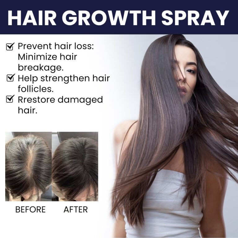 Seurico™ Hair Growth Spary