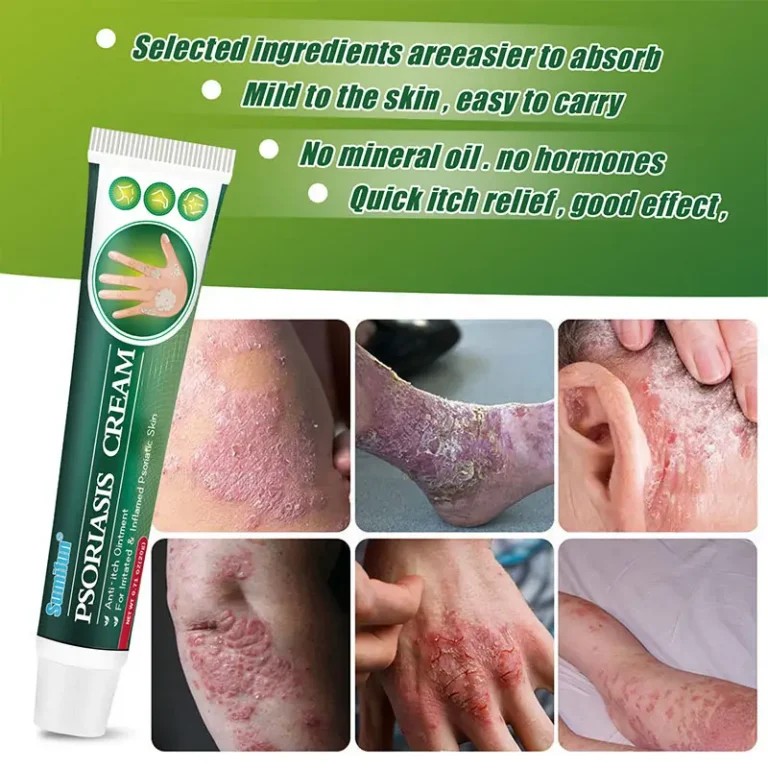 SkinMedix™ Natural Herbaceous Plants Psoriasis Cream