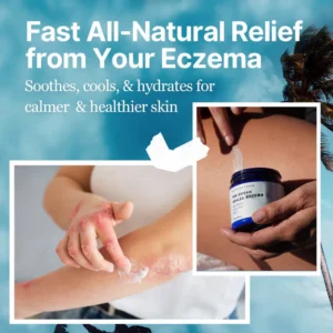 The Ocean Healed Eczema Soothing Cream