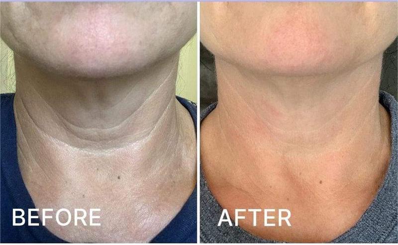 Tighten & Lift FirmingNeck Cream